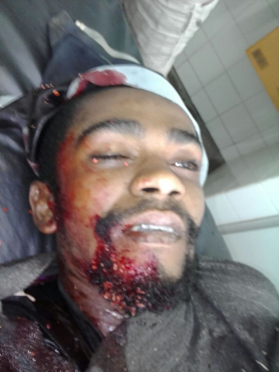 Homem morre em confronto com a policia em Iaçu