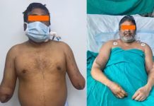 Primeiro transplante bi lateral de mãos da Índia deu certo; 12 horas de cirurgia