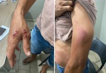 Motorista é agredido com facão durante briga na BR-153