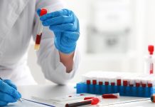 Teste de sangue pode detectar risco de morte por insuficiência cardíaca