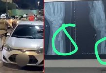 Jovem tem fratura no braço após abordagem violenta da polícia, diz família Familiares dizem que jovem teve braço fraturado após agressão de policiais na Bahia