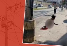 Homem tem mão amputada ao tentar furtar cabos de energia de poste Homem tem mão amputada ao tentar furtar cabos de energia