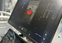 Hospital de Itaberaba recebe mais um aparelho de ultrassom aparelho de ultrassom