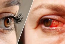 Os riscos à saúde de usar extensões de cílios