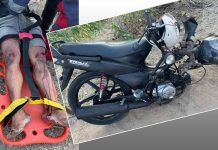 Homem fica ferido após moto se partir ao meio ao passar por quebra-molas