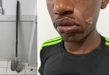 Mulher agride companheiro com golpes de pá após ele chegar tarde em casa