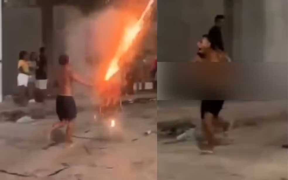 Jovem tem dedo amputado após artefato explodir na própria mão durante 'guerra de espadas'