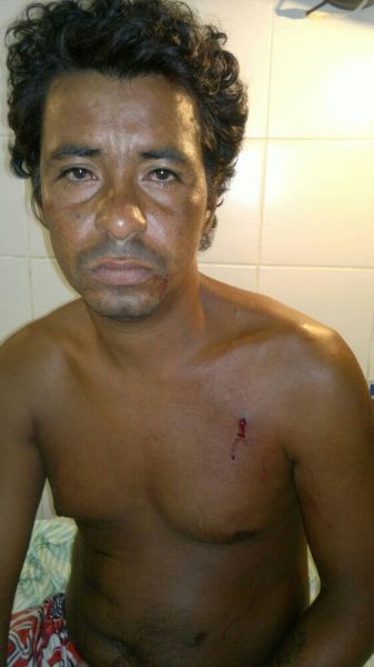 Ruy Barbosa: homem leva tiro, mas não sabe de onde veio