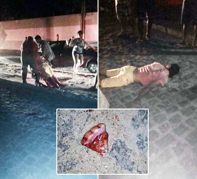 Quebra-molas sem sinalização provoca grave acidente em Itaberaba