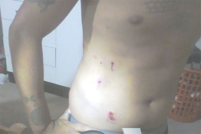 Itaberaba: Homem é baleado no bairro Campo do Governo