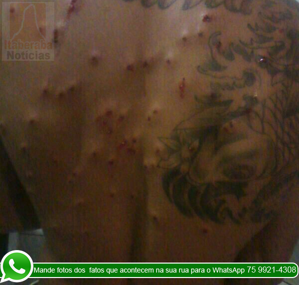 Homem é baleado após show em Itaberaba