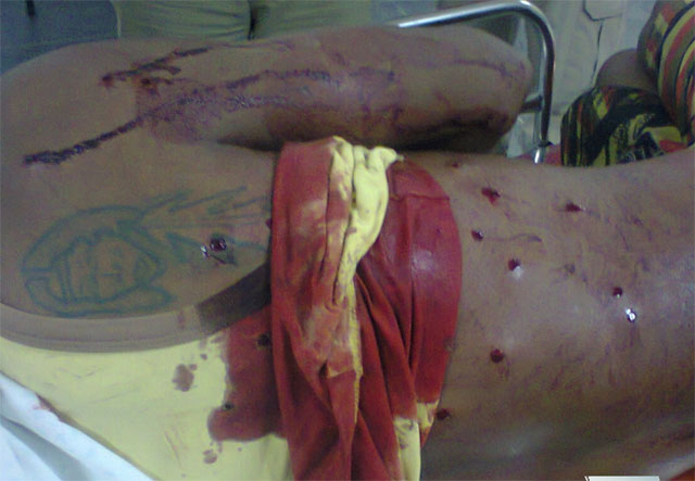 Homem sofre tentativa de assassinato no bairro Caititu