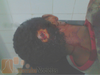 Pichú tenta arrombar residencia e se dar mal em Itaberaba