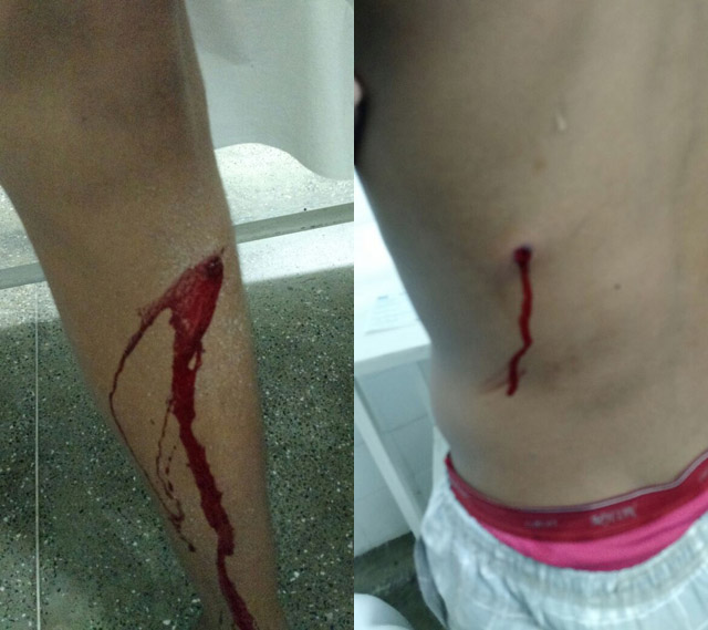 Quatro pessoas ficam feridas com disparos de arma de fogo no centro de Itaberaba