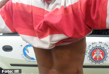 Homem é baleado na Avenida Luiz Viana Filho em Itaberaba