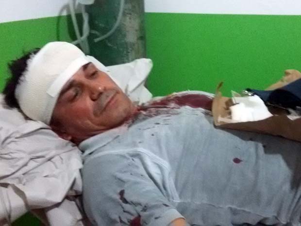 Vereador é espancado na porta de casa em Ibiquera